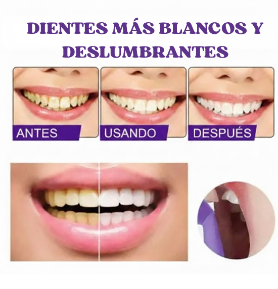 Blanqueador LUMA (EDICIÓN LIMITADA)